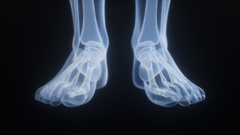 An anatomical rendering of the bones and joints of the feet
